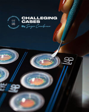 Cartela Challenging Cases CTS + Double Flanged