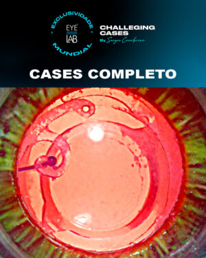 EYELAB Challenging Cases Completo
