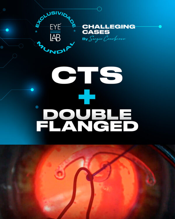 EYELAB Challenging Cases Módulo CTS + Double Flanged - eyelabsimulator.com