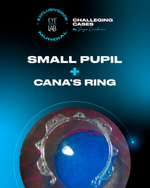 EYELAB Challenging Cases Módulo Small Pupil + Faco