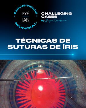 EYELAB Challenging Cases Módulo Técnicas de Suturas de Íris