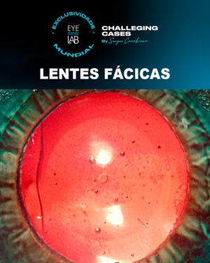 EYELAB Lentes Fácicas